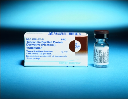 Ppd Tubersol Tuberculin, Vl 5tu/0.1ml 1ml 10test Snofps