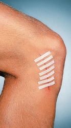 Suture Strip Flexible Wound Closure Strip 1/4" x 3"