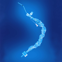 KIMVENT Closed Suction System 14 fr T-Piece Blue