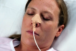 NasoGastric Tube Holder, One Size Fits All