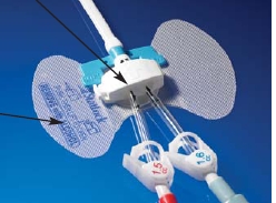 Statlock Dialysis Cath Securement Device