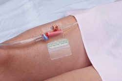 Hold-n-Place Foley Catheter Holder Adhesive Patch, One Size Fits All