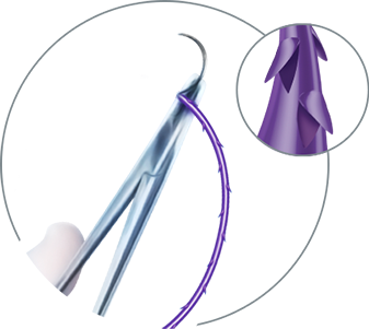 Quill R.A.R.P. Kit; (1 ea) VLP-2015, (2 ea) VP-2000Q, (1 ea) VLM-2005; (2 ea) Y427N